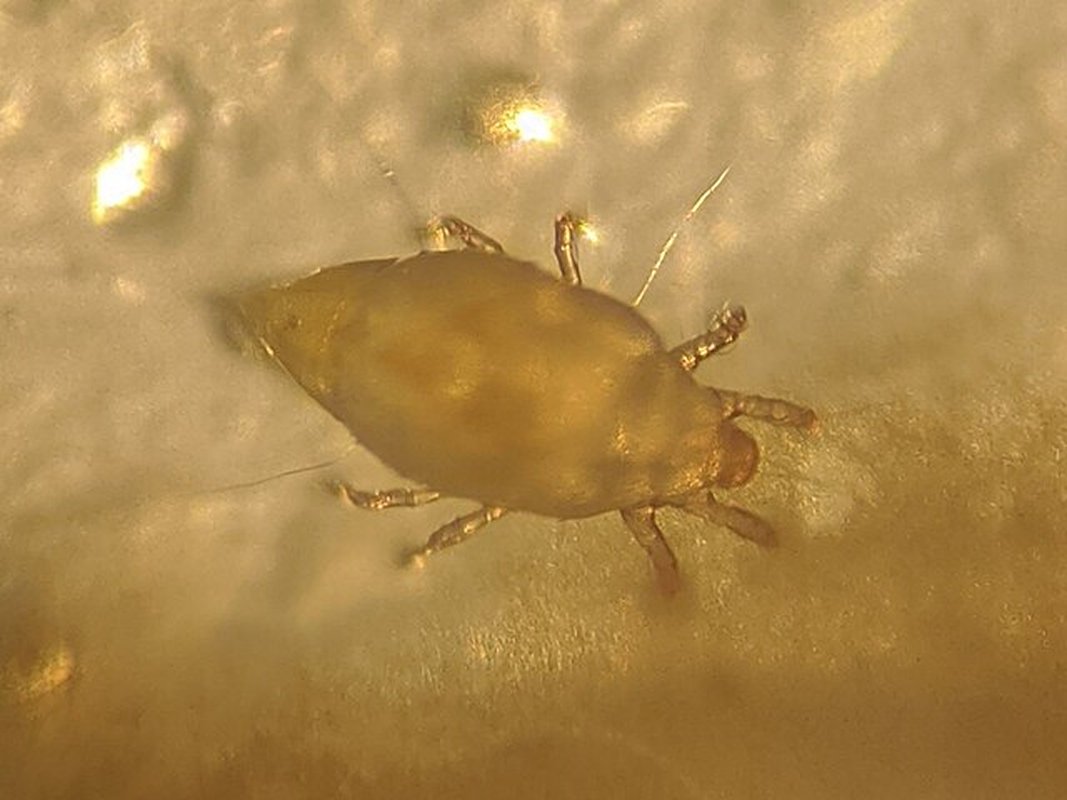 gros plan microscope sur acarien